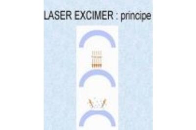 Khí Laser Excimer